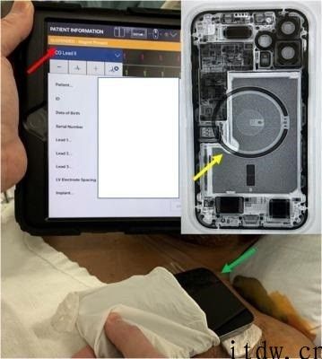 iPhone iPhone 12 实测可逼停心脏除颤器，磁场强度远高出几款手机上