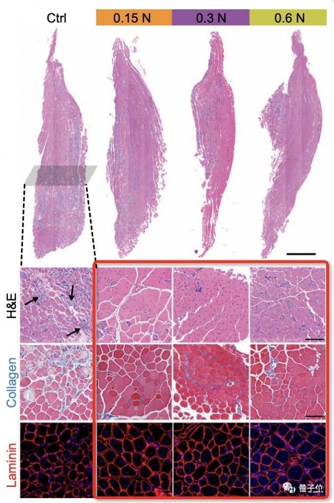 按摩加快肌肉修复有科学依据了,哈佛大学研究成果登 Scien