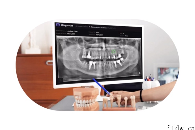AI齿科成像技术在加拿大获批,可识别三十余种齿科疾病
