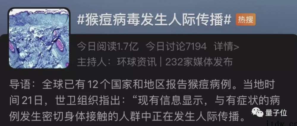 猴痘病毒发生人际传播,致死率可达 10%,世卫组织:主要但不