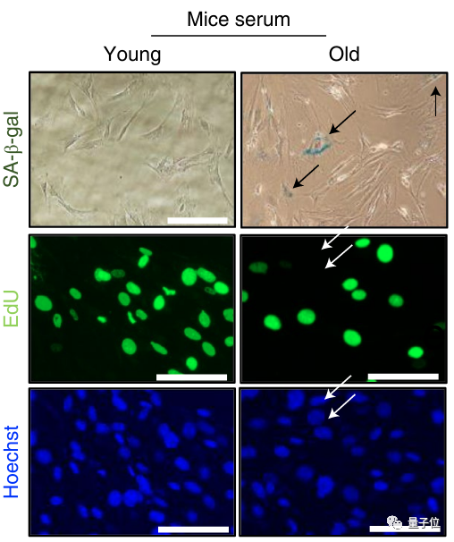 衰老进程可操控!换血大法开创团队新突破,人类离破解衰老之谜