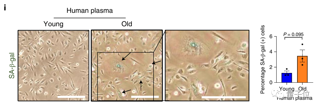 衰老进程可操控!换血大法开创团队新突破,人类离破解衰老之谜