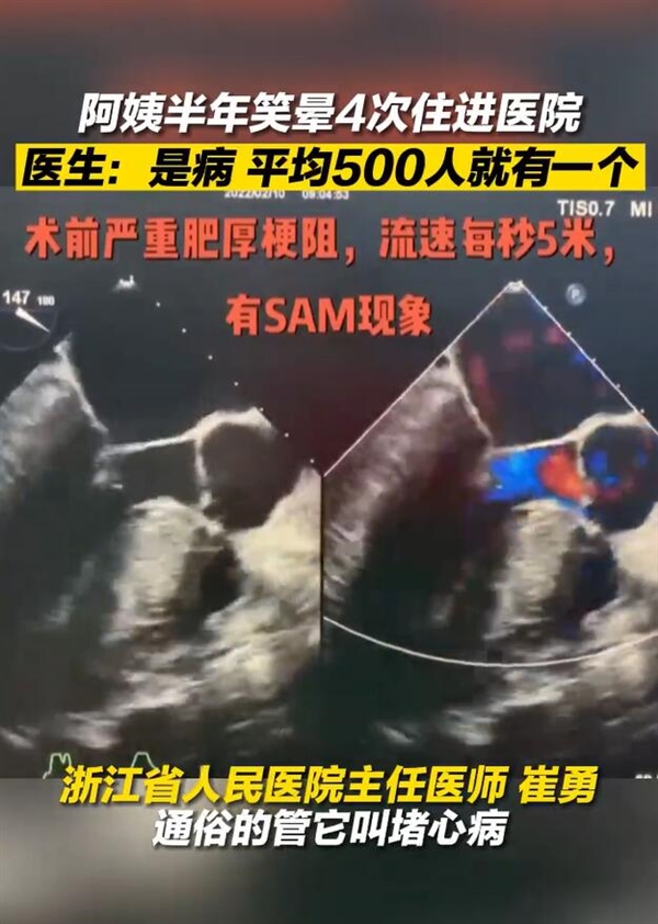 浙江一女子半年笑晕4次上热搜！医生道出病因