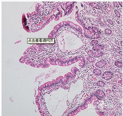 直肠炎在哪里(直肠炎疼痛位置在哪里)