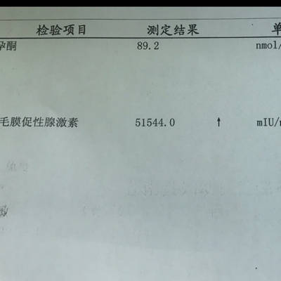 孕6周孕酮是多少nmol(孕6周孕酮是多少好大夫在线)