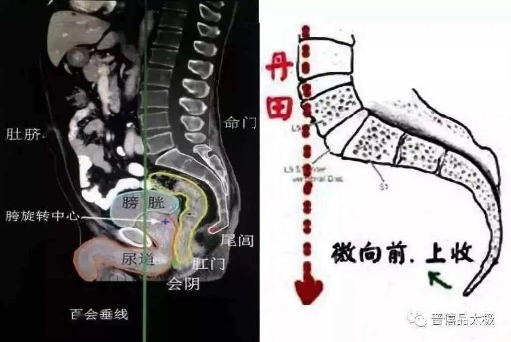 椎骨在哪个位置图片(腰5骶1椎间盘位置图)