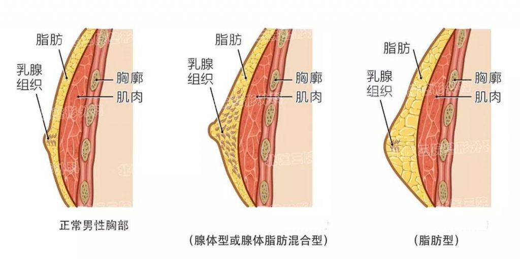 检查女孩子胸部发育早挂哪个科的简单介绍