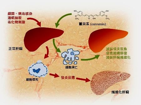 怎样治纤维化(纤维化骨髓治疗方法)