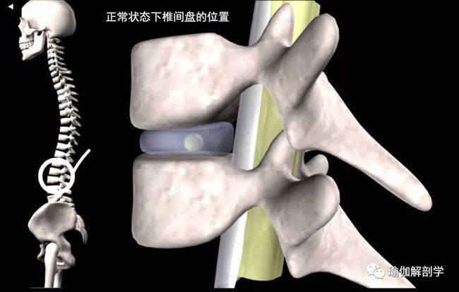 腰椎间盘厉害的需要做手术吗(腰椎间盘突出做手术需要多少钱)