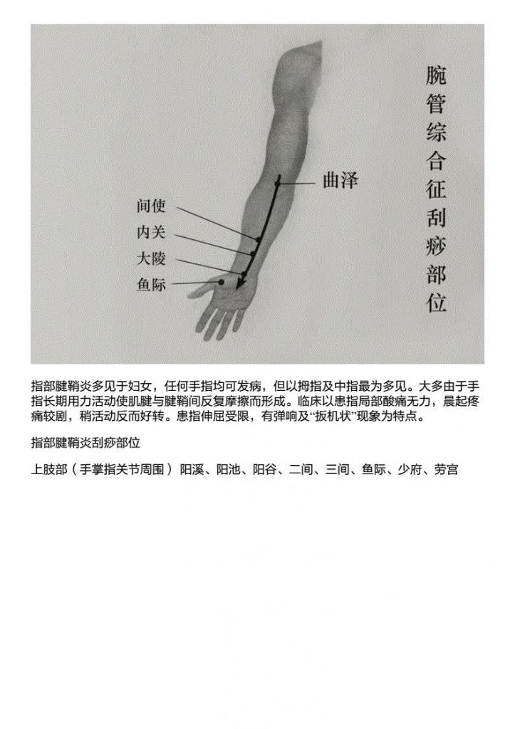 腕在哪个部位(手臂穴位图解大全)