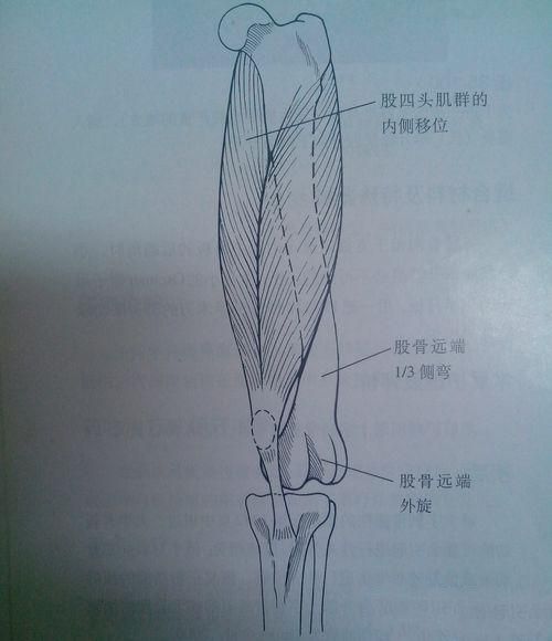 四头肌在哪里(肱四头肌在哪里)