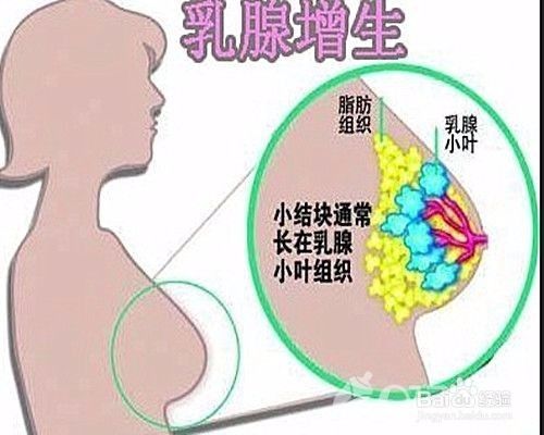 乳腺小叶在哪里(乳腺小叶增生在哪个部位)