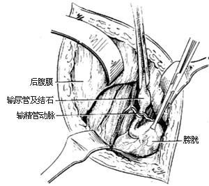 输尿管和膀胱入口的直径是多少的简单介绍