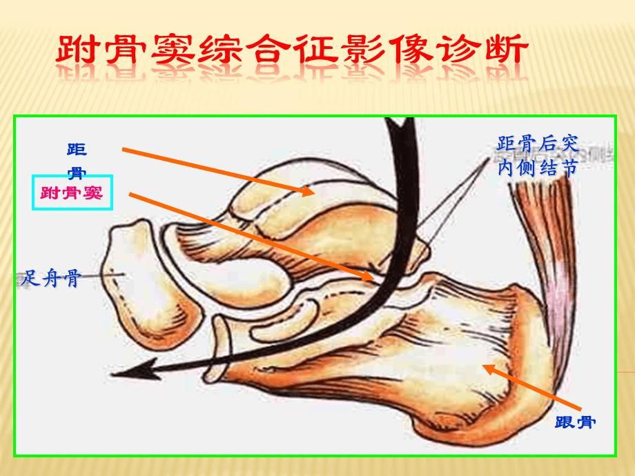 跗骨在哪里的简单介绍