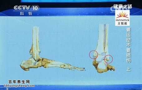 关节在哪(关节在哪里)