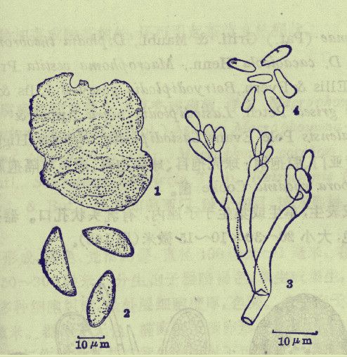 蛇莲化斑散在哪买(蛇莲化斑散药店有卖吗)