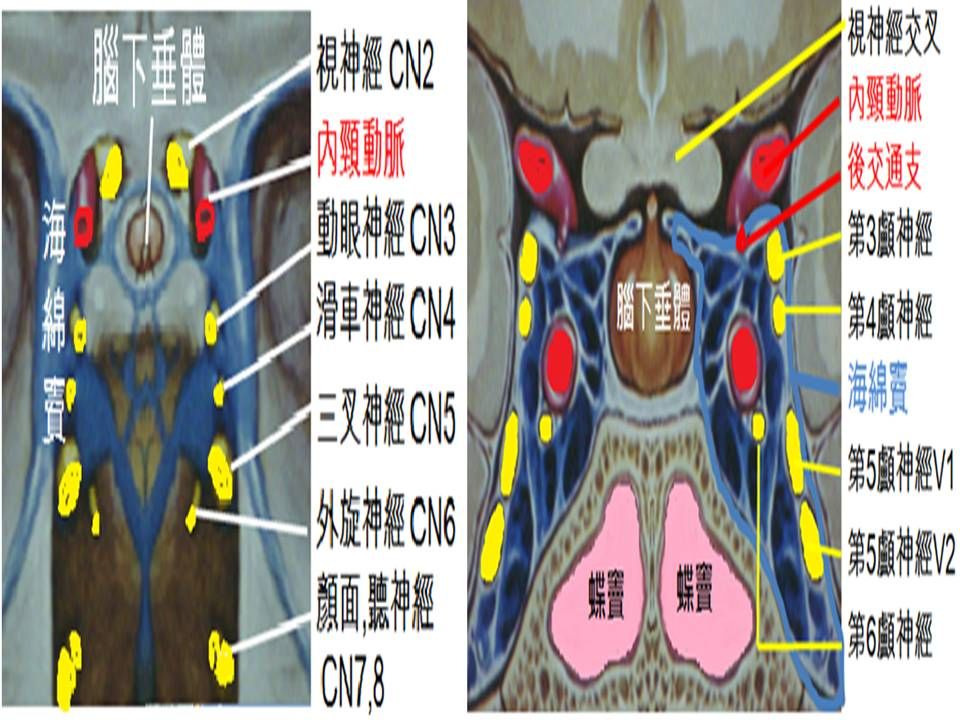 海绵窦在哪里(海绵批发市场在哪里)