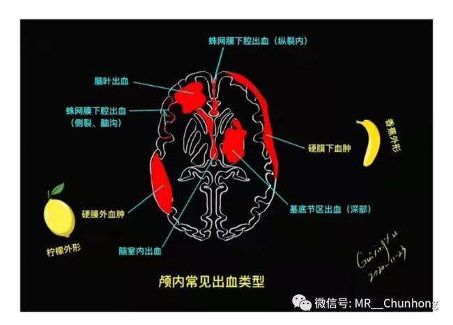 反枕在哪的简单介绍