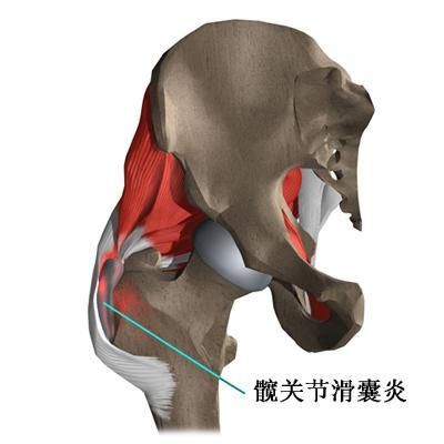 滑囊在哪里(腋下滑囊在哪里)