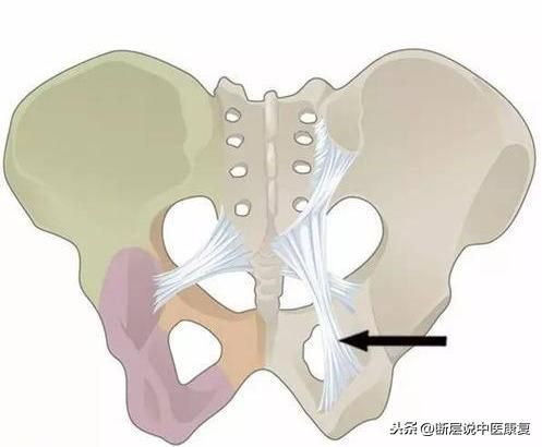 屁股线在哪(屁股先锋同人图)