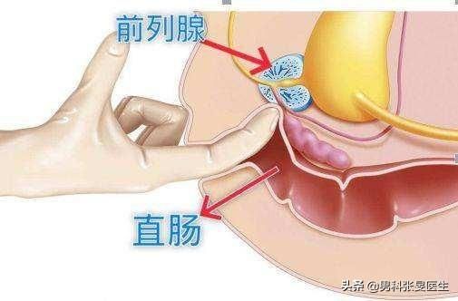 男人的前列腺在哪里(前列腺是指哪个部位)