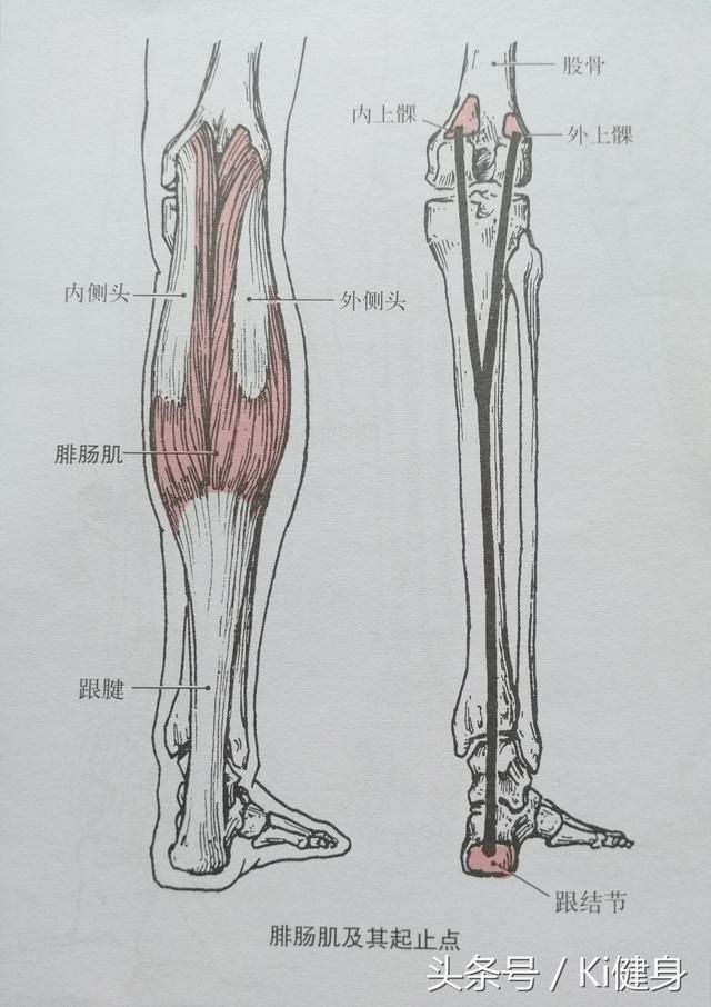 小腿肌腱在哪(小腿肌腱拉伤怎么恢复)