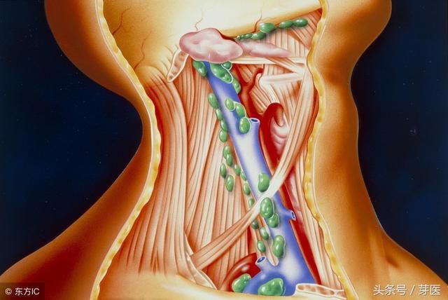 下颚淋巴在哪(下颚淋巴结肿大)