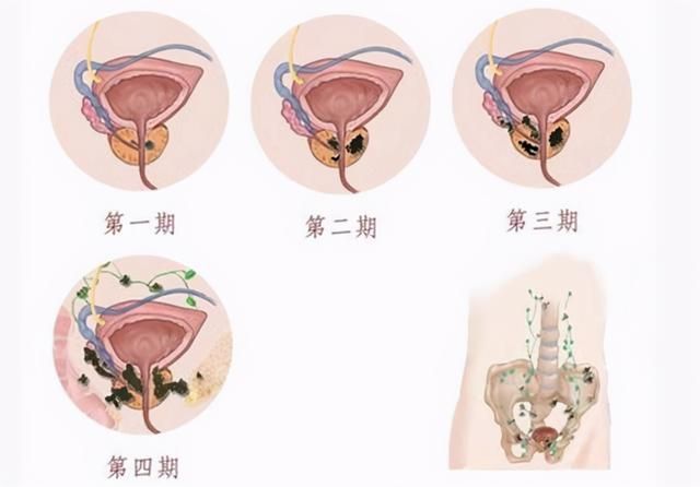 前列腺位置在哪图片(前列腺位置在哪个部位)